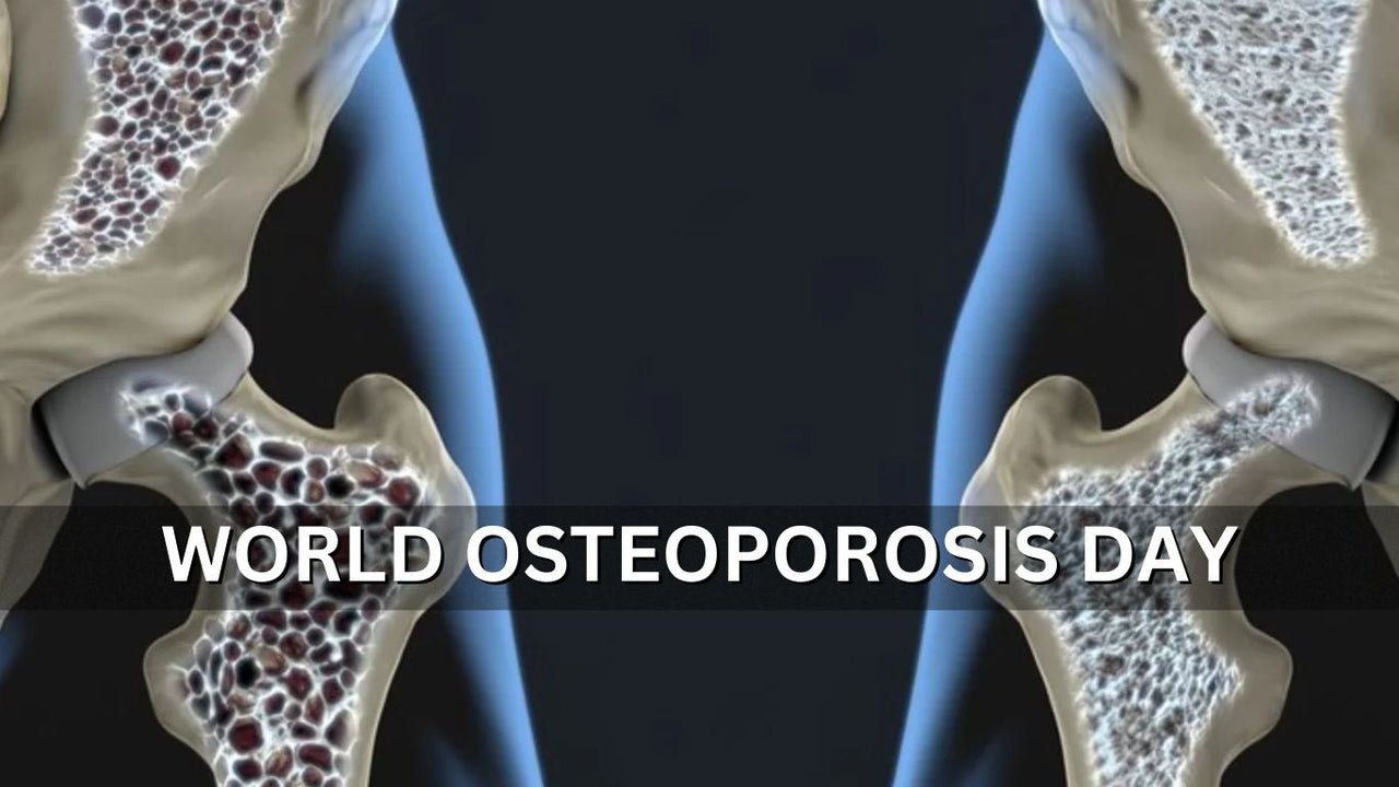 Building Better Bones: A Guide to World Osteoporosis Day 2023